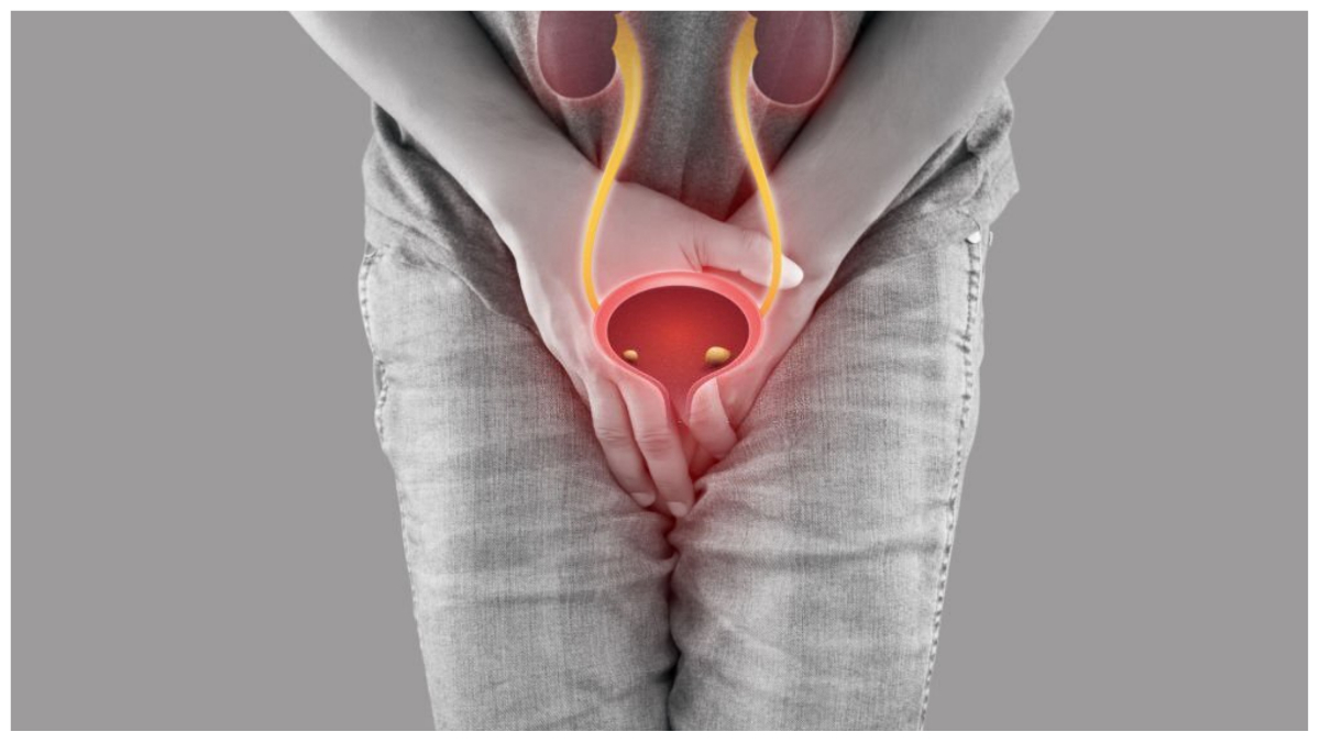 લેસર મશીન